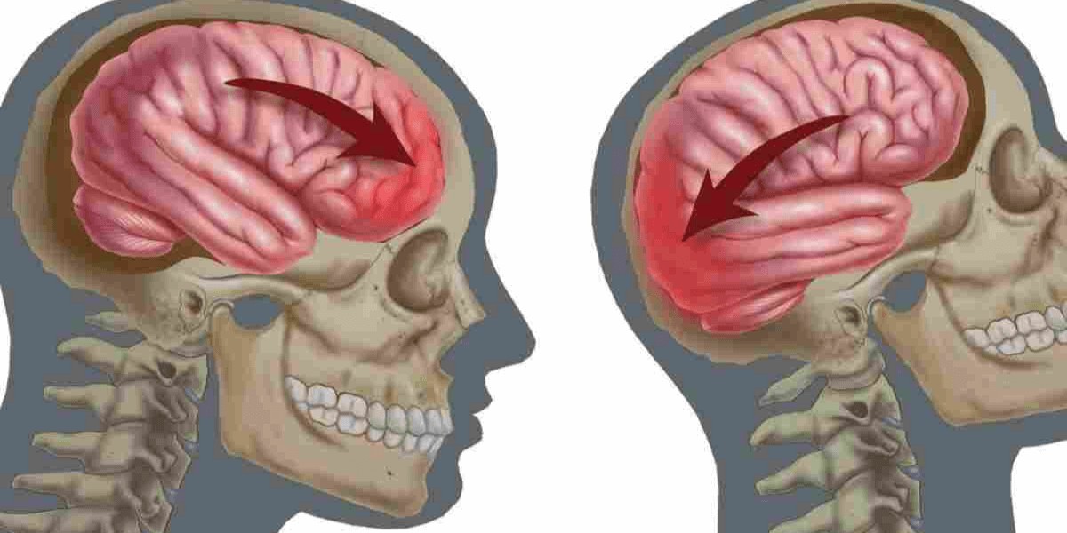 Чи небезпечна контужена людина