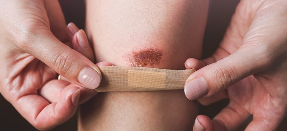 чим обробити рану дитині