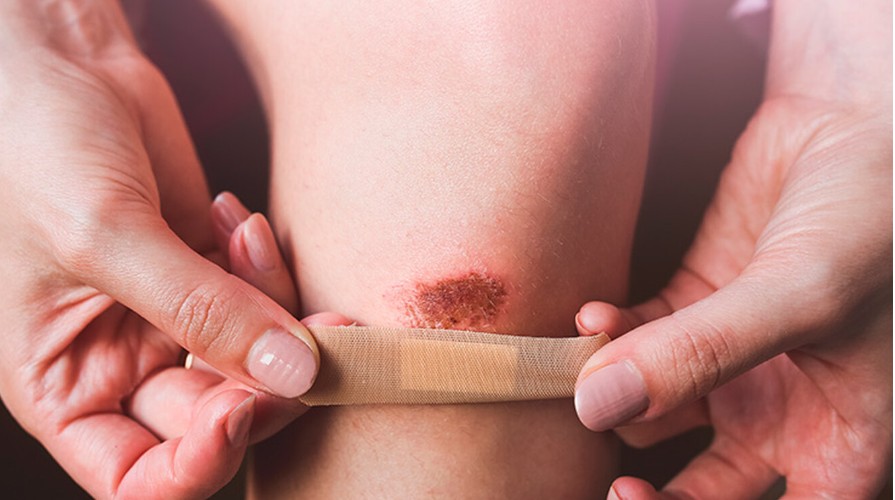 правець симптоми