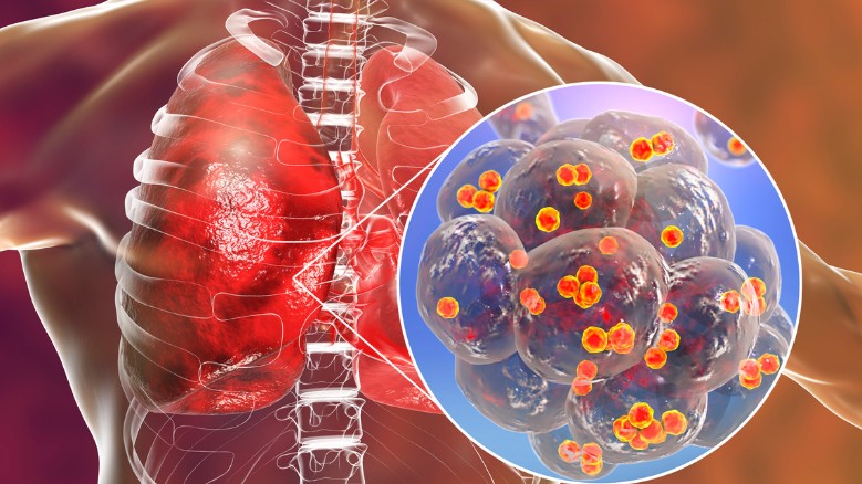 Який лікар лікує стафілокок