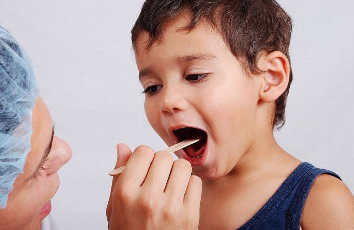 гнійна ангіна: лікування в домашніх умовах