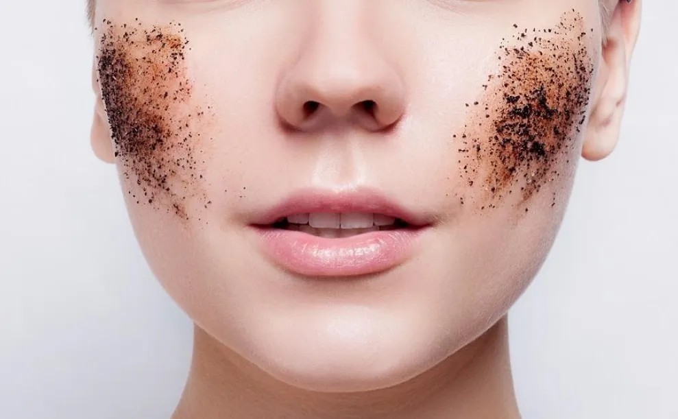 що таке комедони