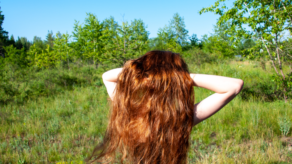 синдром Рапунцель